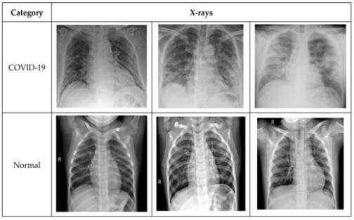 CNN Models Using Chest X-Ray Images for COVID-19 Detection: A Survey ...